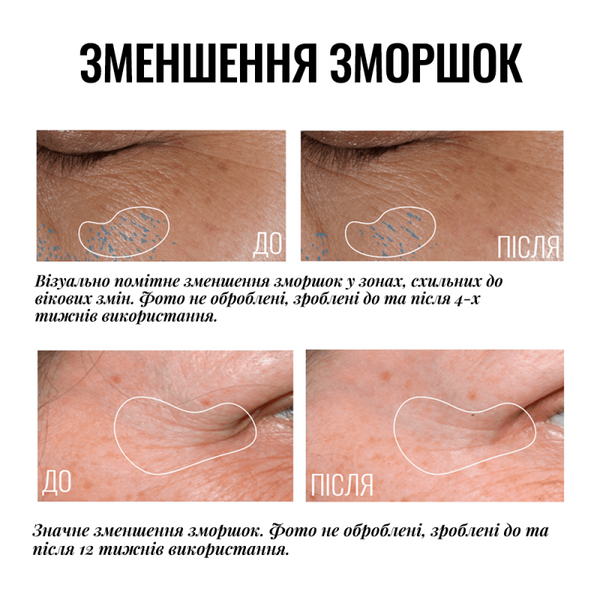 Крем-лифтинг для век с осветительным эффектом Instytutum Truly-Transforming Brightening Eye Cream (15 ml) 1680 фото