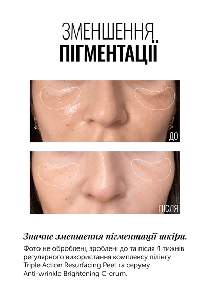 Суперконцентрированный серум с витамином C Instytutum Anti-wrinkle Brightening C-Erum (30 ml) 1682 фото