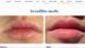 Бальзам для губ Lanolips 101 Ointment Multipurpose Superbalm (15 g) 4002 фото 3