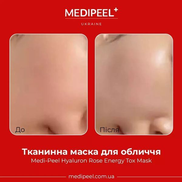 Тканевая ампульная маска Medi-Peel Hyaluron Rose Moisture Ampoule Mask (1 ea) 3793 фото