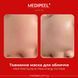 Тканевая ампульная маска Medi-Peel Hyaluron Rose Moisture Ampoule Mask (1 ea) 3793 фото 2